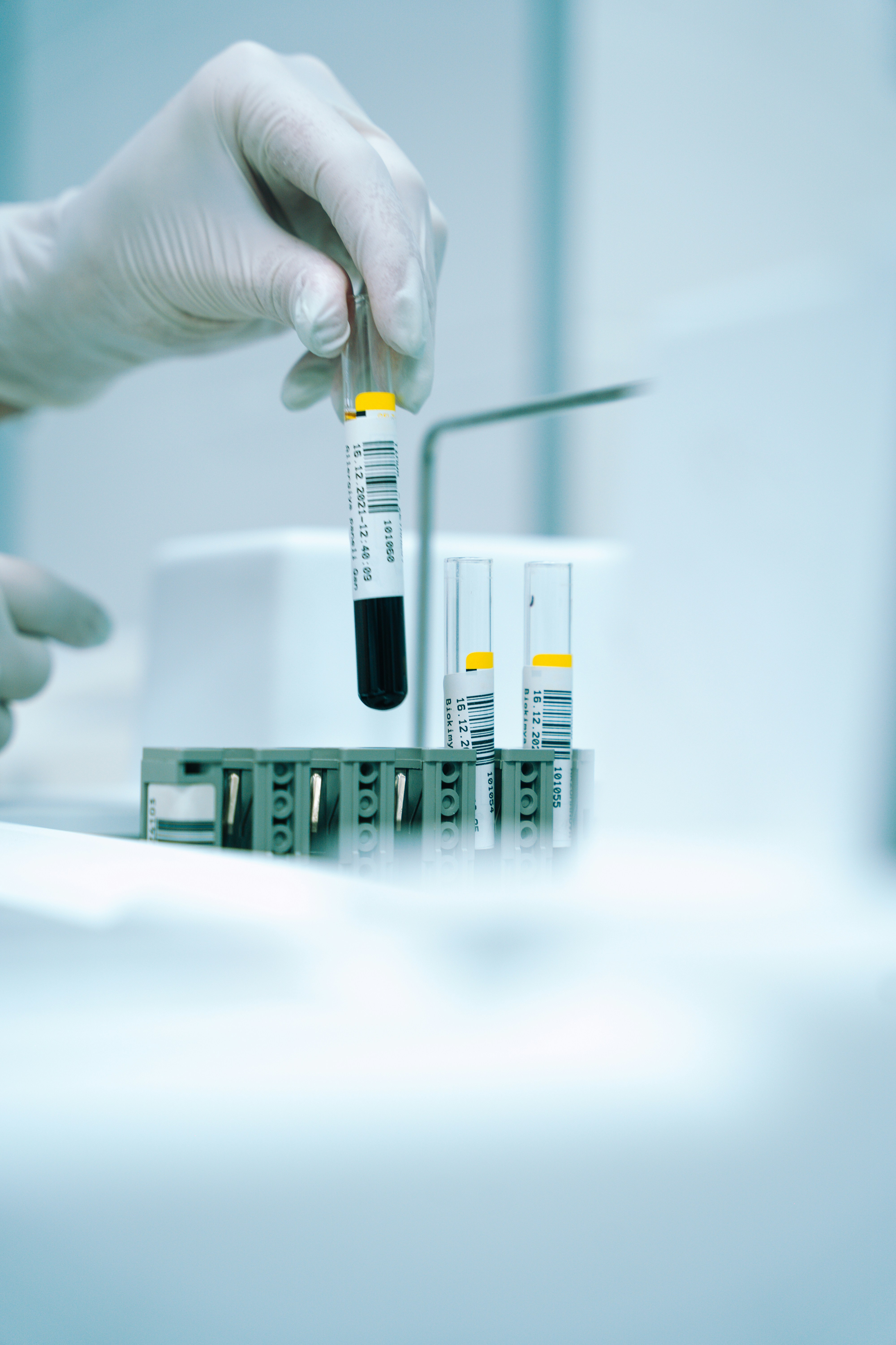 Análisis e investigación científica de grado médico en laboratorio para EBE LIFE